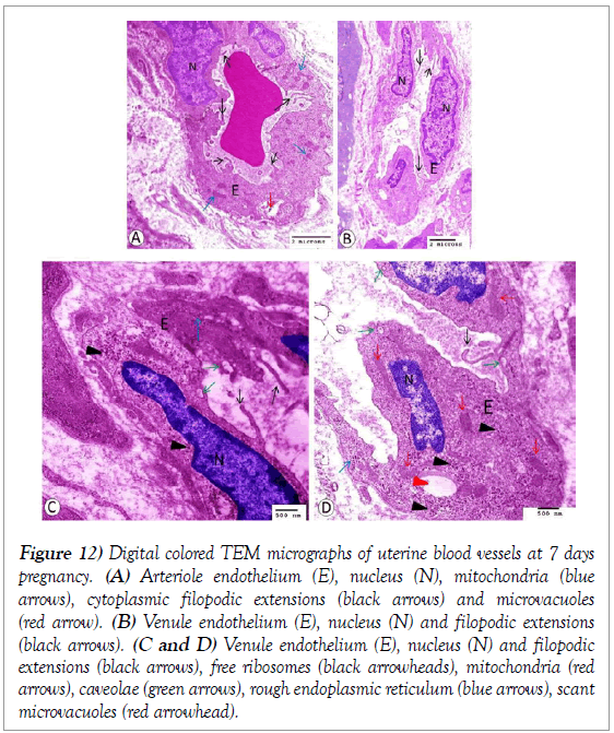 histology-histopathology-research-micrographs-uterine-blood