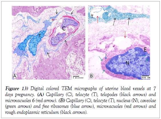 histology-histopathology-research-micrographs-uterine-blood