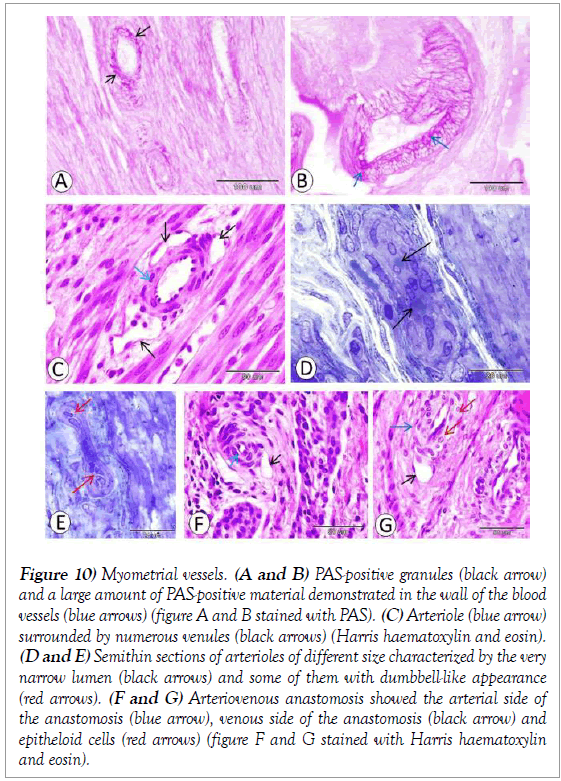 histology-histopathology-research-myometrial-vessels-granules