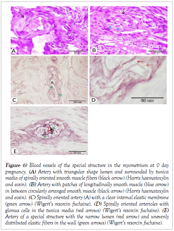 histology-histopathology-research-myometrium-pregnancy-lumen