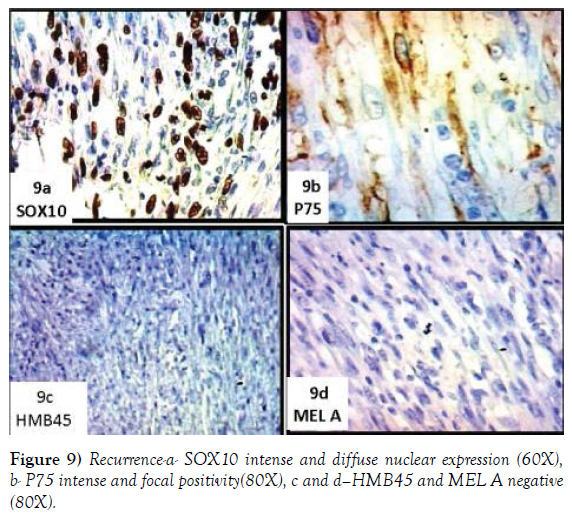 histology-histopathology-research-nuclear-expression