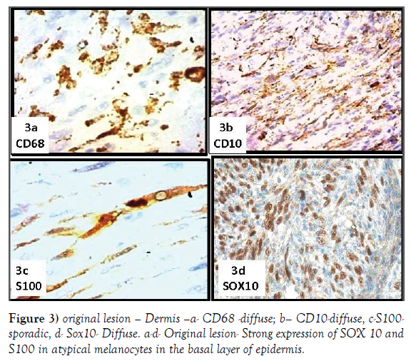 histology-histopathology-research-original-lesion