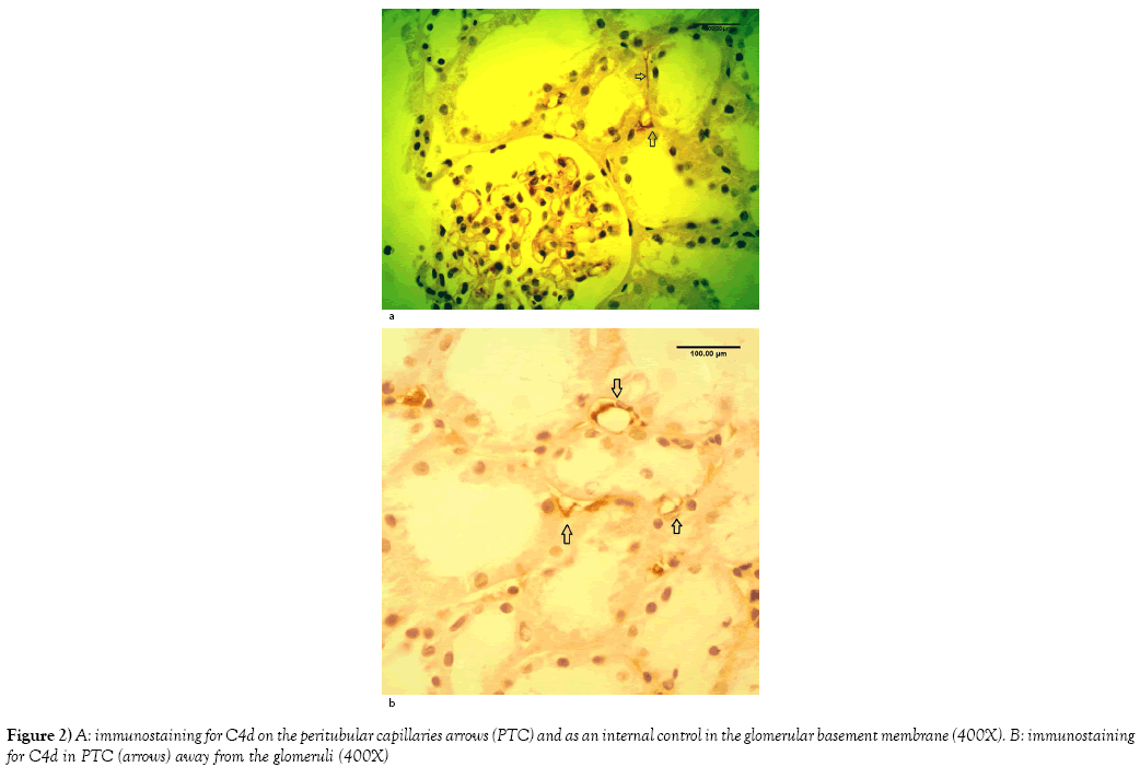 histology-histopathology-research-peritubular-capillaries