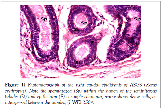 histology-histopathology-research-photomicrograph-caudal-epididymis