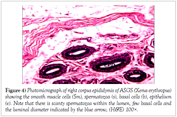 histology-histopathology-research-photomicrograph-corpus-epididymis