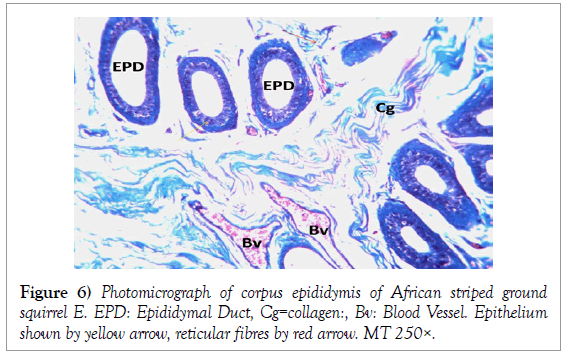 histology-histopathology-research-photomicrograph-corpus-epididymis