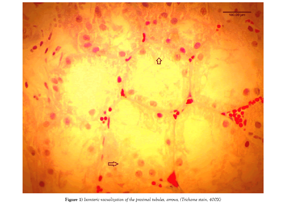 histology-histopathology-research-proximal-tubules