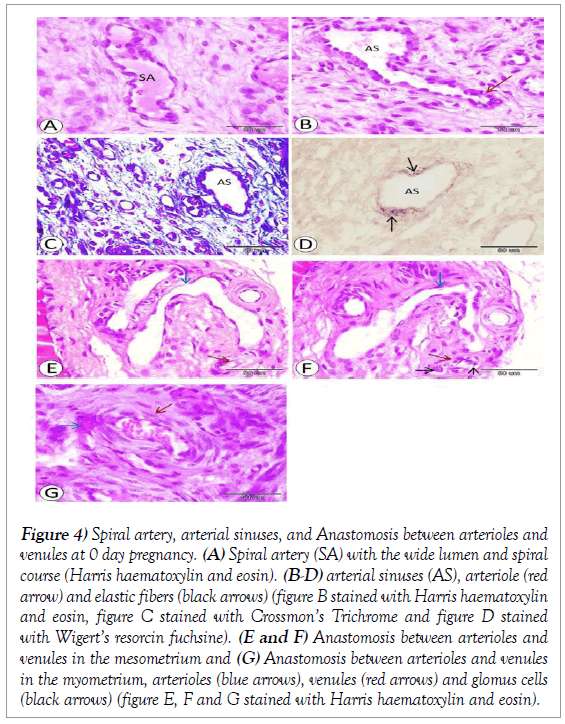 histology-histopathology-research-spiral-artery-arterial