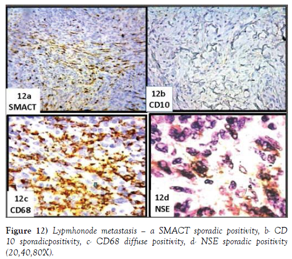 histology-histopathology-research-sporadic-positivity