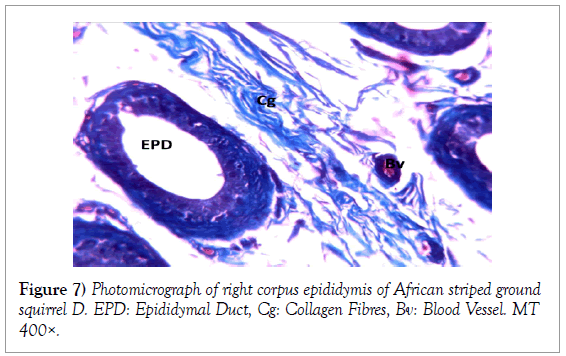 histology-histopathology-research-striped-squirrel-epididymal