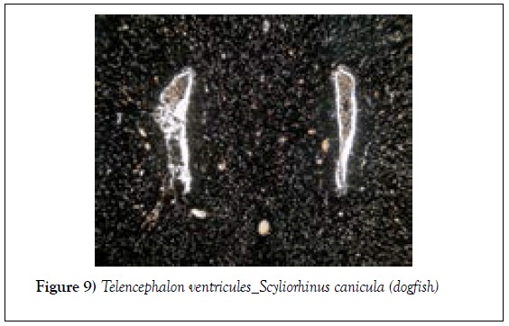 histology-histopathology-research-telencephalon-ventricules