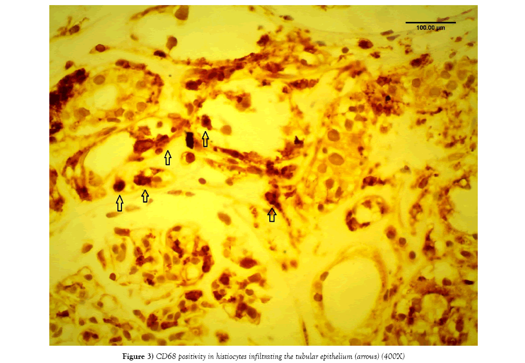 histology-histopathology-research-tubular-epithelium
