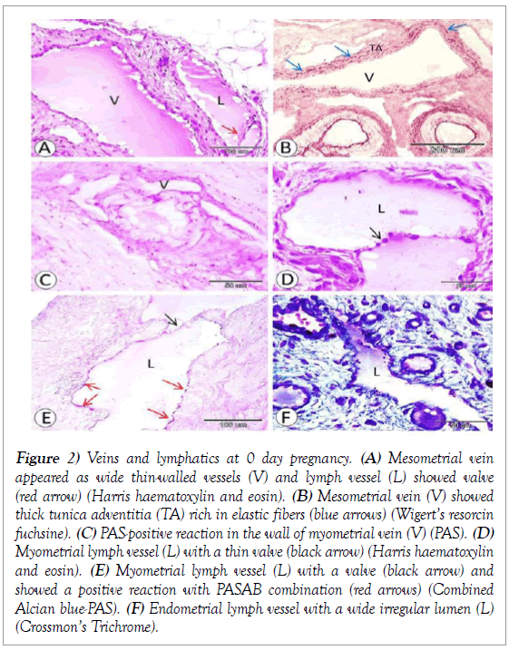 histology-histopathology-research-veins-lymphatics-mesometrial