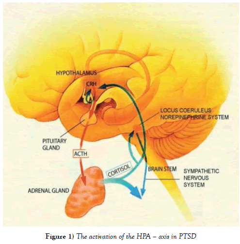 integrative-medicine-activation-HPA-axis-PTSD