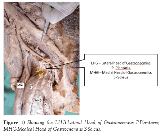 international-journal-anatomical-variations-Gastronecmius