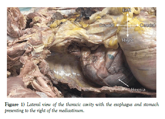 international-journal-anatomical-variations-Lateral-view