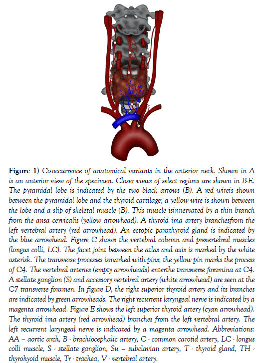 international-journal-anatomical-variations-anatomical