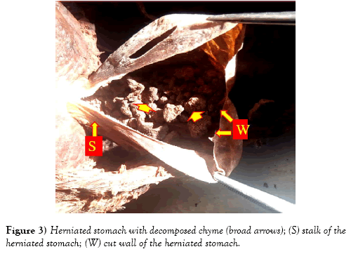 international-journal-anatomical-variations-arrows