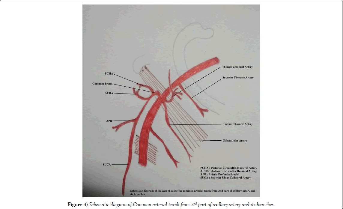 international-journal-anatomical-variations-arterial-trunk