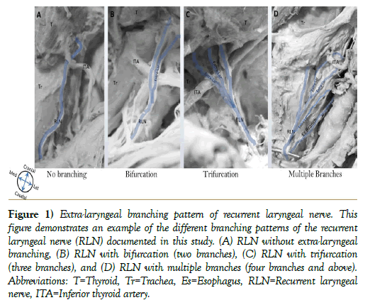 international-journal-anatomical-variations-branching