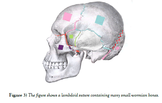 international-journal-anatomical-variations-containing