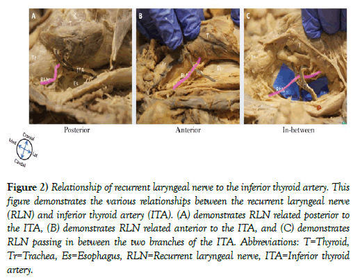 international-journal-anatomical-variations-demonstrates