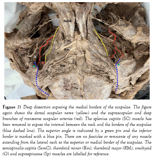 international-journal-anatomical-variations-labelled