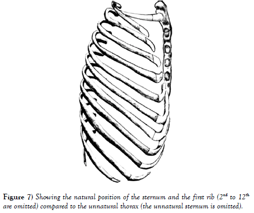 international-journal-anatomical-variations-omitted