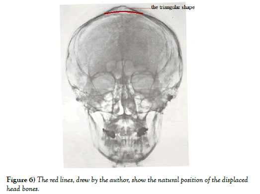 international-journal-anatomical-variations-position