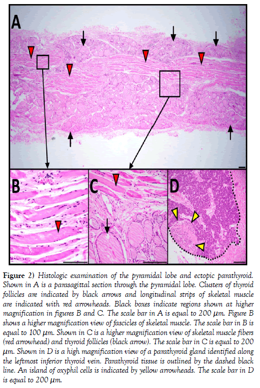 international-journal-anatomical-variations-pyramidal