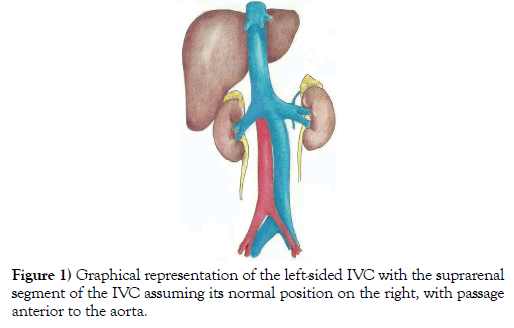 international-journal-anatomical-variations-representation