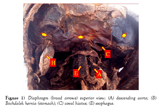 international-journal-anatomical-variations-superior