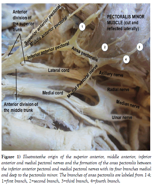 international-journal-anatomical-variations-superior