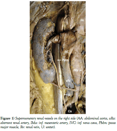 international-journal-anatomical-variations-vessels