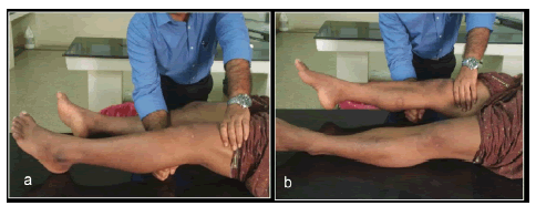 intramuscular-myxoma-demonstrated