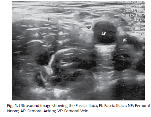 jotsrr-fascia