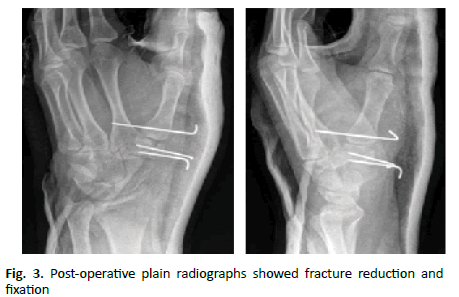 jotsrr-radiographs