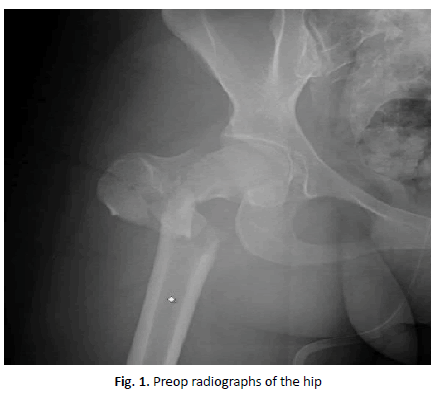 jotsrr-radiographs