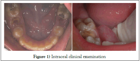 journal-dental-oral-research-Intraoral-clinical