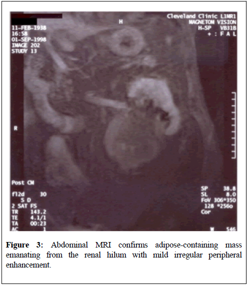 kidney-treatment-diagnosis-adipose-containing