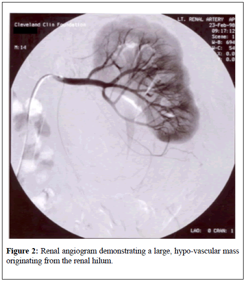 kidney-treatment-diagnosis-hypo-vascular