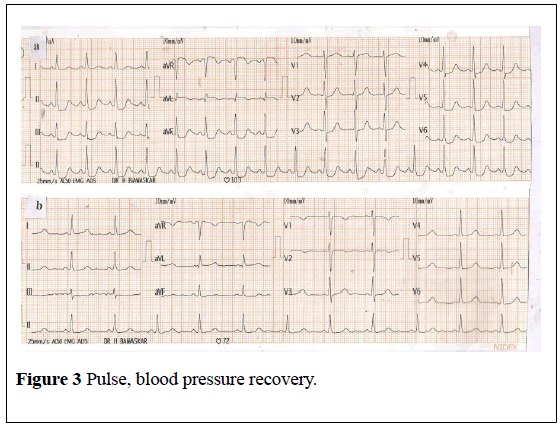 medical-toxicology-blood-pressure