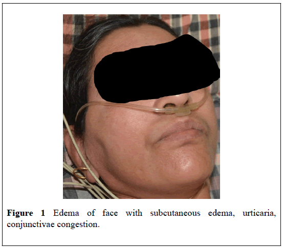 medical-toxicology-subcutaneous-edema