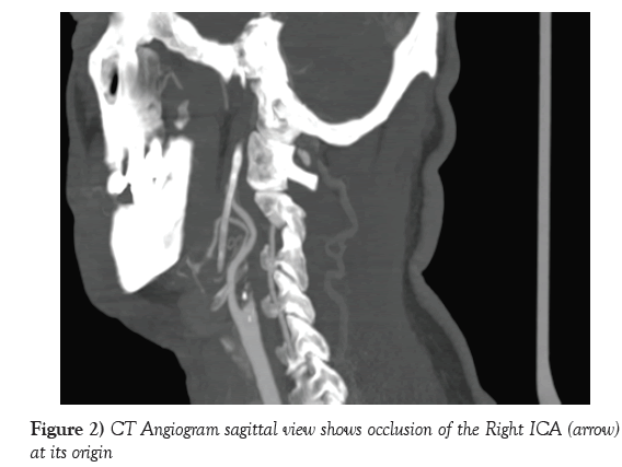 neurology-clinical-neuroscience-Angiogram-sagittal