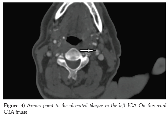 neurology-clinical-neuroscience-Arrows-point