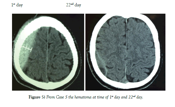 neurology-clinical-neuroscience-Case-5