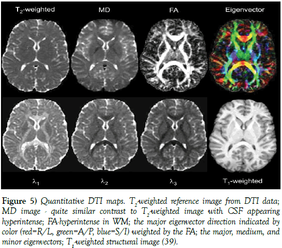 neurology-clinical-neuroscience-Quantitative-DTI-maps