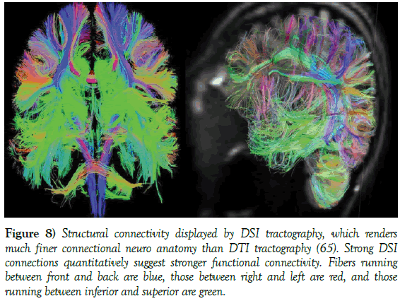 neurology-clinical-neuroscience-Structural-connectivity