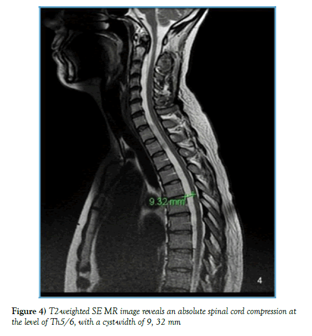 neurology-clinical-neuroscience-absolute-spinal