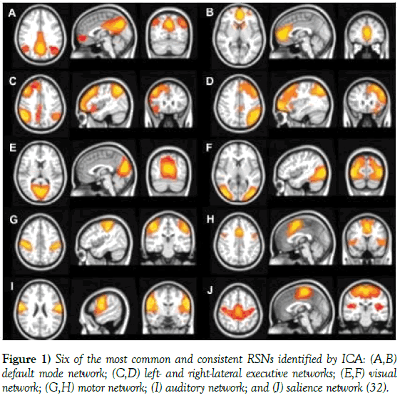 neurology-clinical-neuroscience-auditory-network